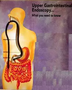 Higher Rates of Lymphoproliferative Disorders in Patients with Celiac Disease  