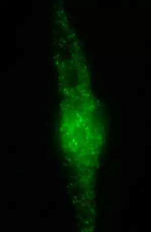 Possible Link Between TG6 Autoantibodies and Celiac Disease with Epilepsy and Cerebral Calcifications