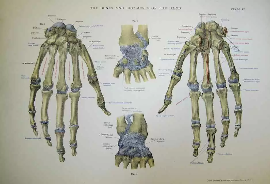 Can Carpal Spasm Be One of the First Signs of Celiac Disease?