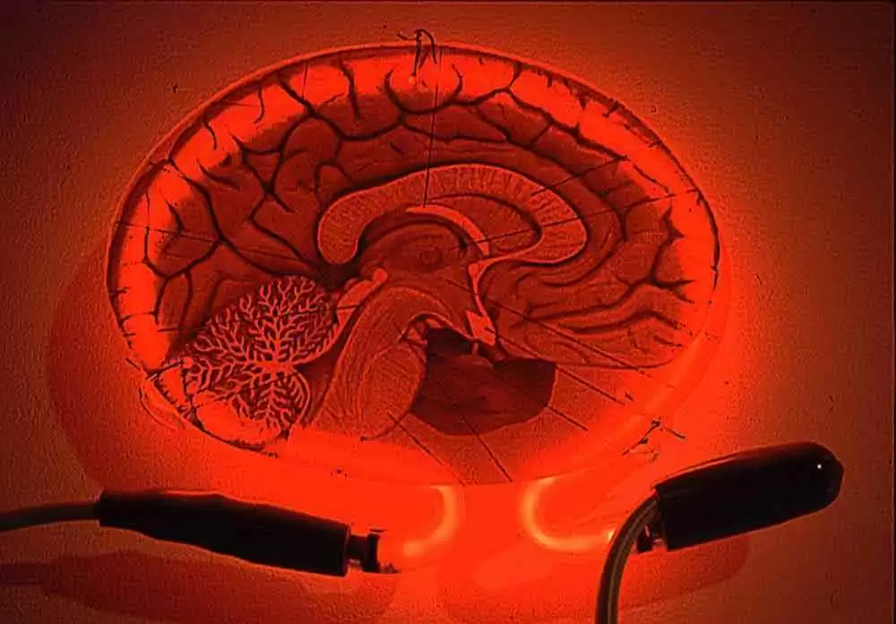 Are People with Celiac Disease More Likely to Have Cognitive Impairment At Diagnosis?