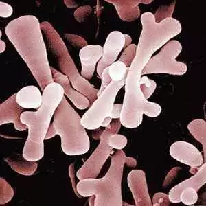 Can Bifidobacterium infantis Natren Life Start Strain Help Active Celiac Disease?