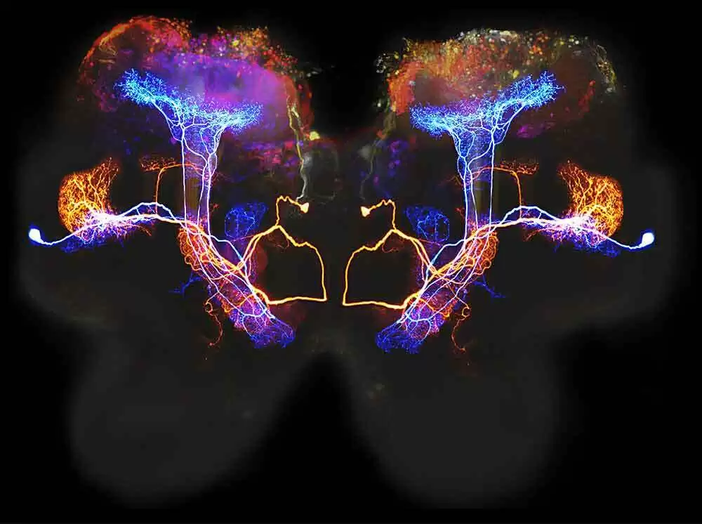 Gluten-Free Diet Helps Treat Neurological Manifestations of Gluten Sensitivity and Celiac Disease