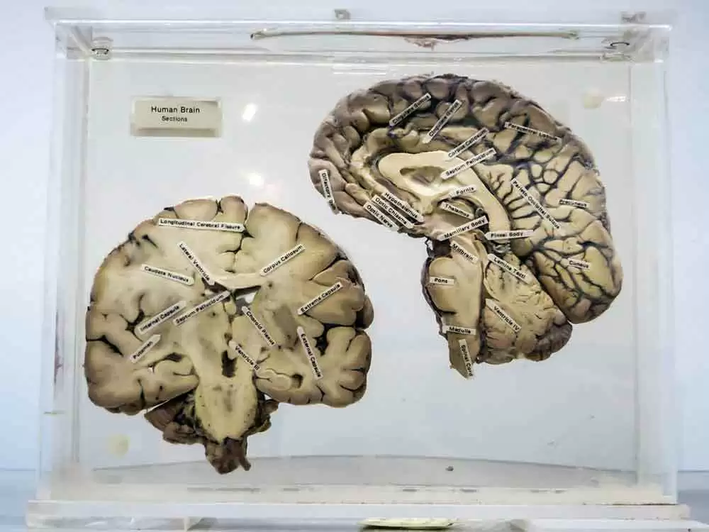 Common Neurologic Deficits in New Celiac Patients Linked With Autoimmunity to Transglutaminase 6