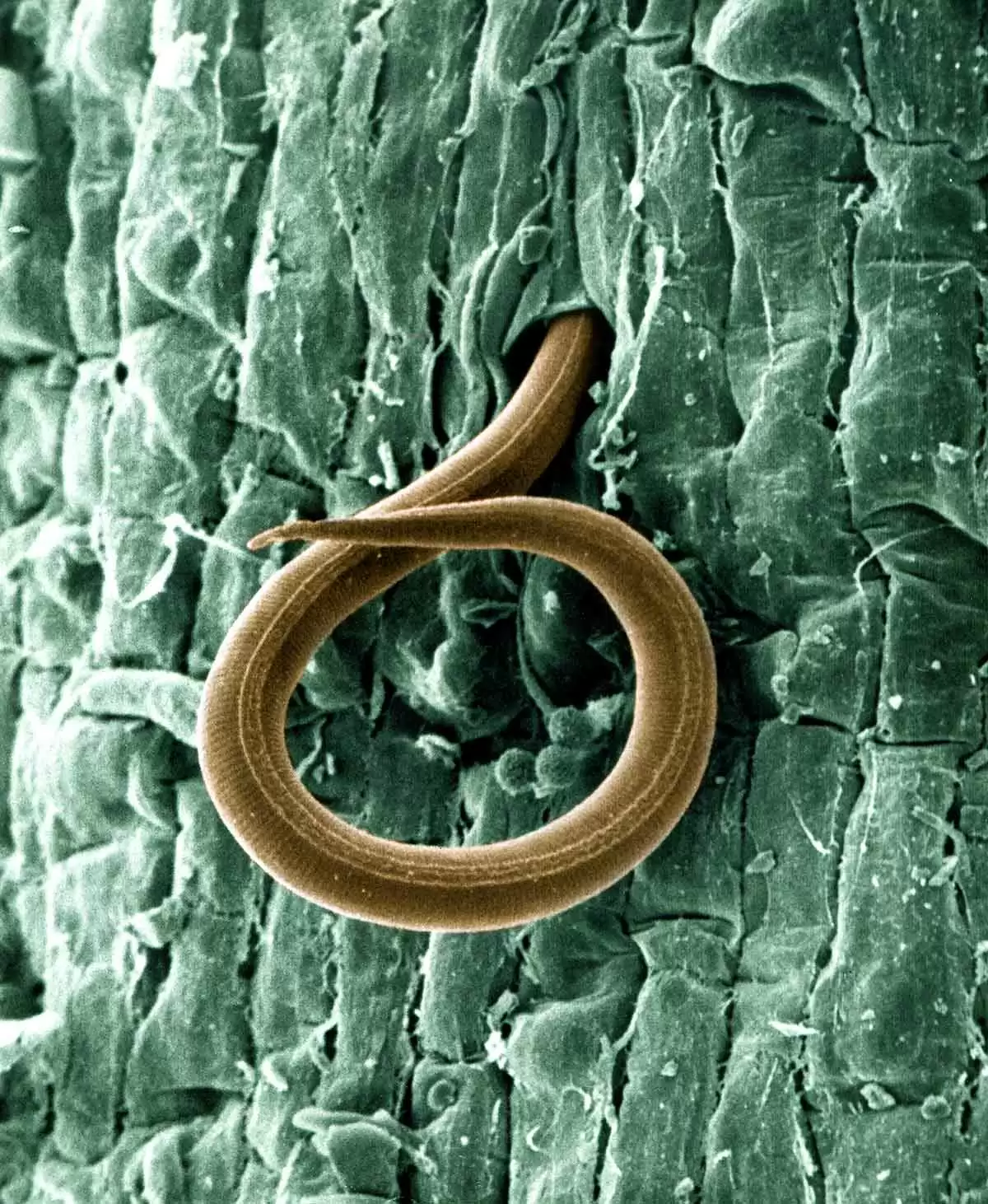 Can Venom from Parasitic Worms Help Treat Celiac Disease? - Image: CC BY 2.0--USDA-ARS