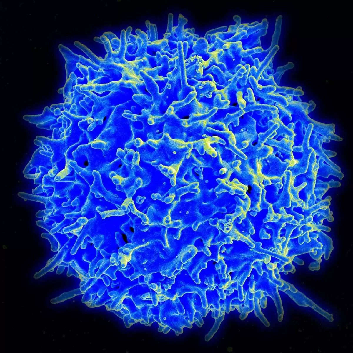 Human TCR-like Antibody Detects Celiac Disease Gluten Peptide–MHC Complexes and Inhibits T cell Activation - Healthy Human T Cell. Image: CC BY 2.0--NIAID