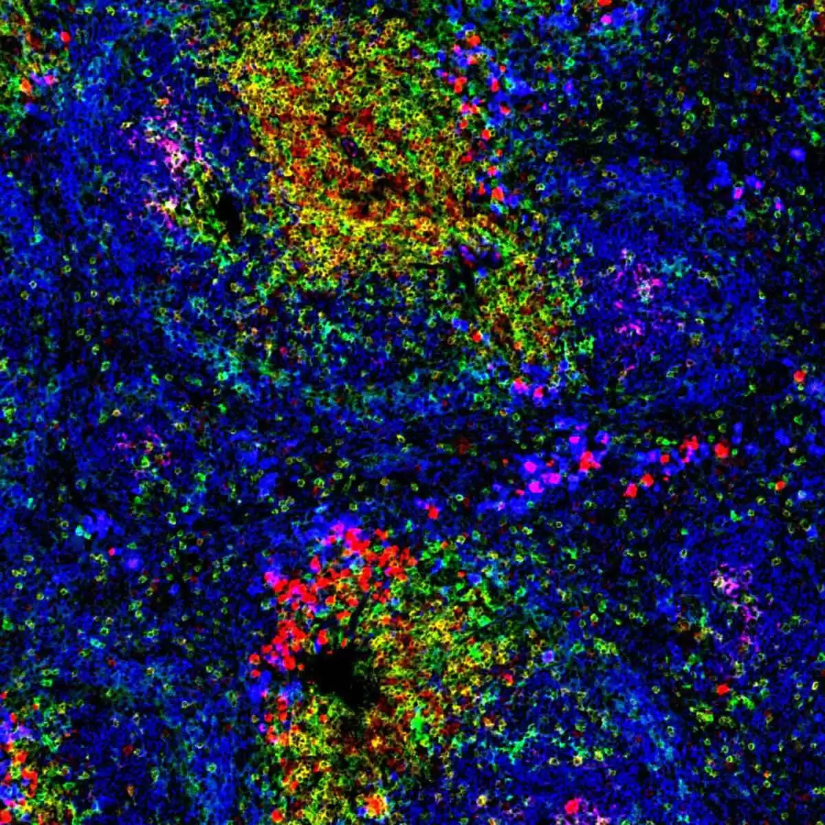 Efficient T Cell–B Cell Collaboration Guides Autoantibody Epitope Bias and Onset of Celiac Disease - Normal spleen showing B cells and T cells. Image CC BY 4.0--wellcomecollection.org