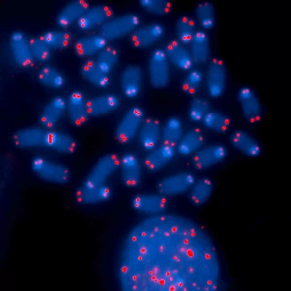 Improving Celiac Disease Diagnosis with Improved HLA-based Prediction - Chromosome Ends. Image: CC BY-NC 2.0--NIH Image Gallery