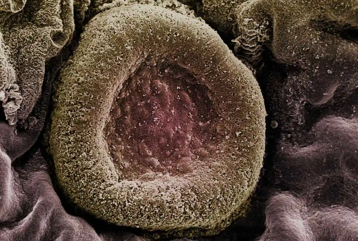 Gluten and Pathogens Connection Holds Implications for Celiac Disease and Gluten-Related Disorders - Streptococcus pneumoniae. Image: CC BY 4.0--Debbie Marshall