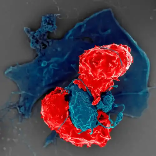 Understanding the Role of Gut Lining Cells in Celiac Disease - T Regulatory Cells by National Institutes of Health (NIH) is marked with Public Domain Mark 1.0.